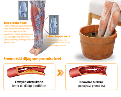 Aeehfeng™ 30-biljna perla za mršavljenje i detoksikaciju stopala-🦵👩‍⚕️(ESL certifikat, Limfatičko udruženje Amerike)