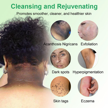 🌲🌲🌲Pročišćavajući gel za piling za Acanthosis Nigricans, piling, tamne mrlje, kožne mrlje i ekceme✨✨