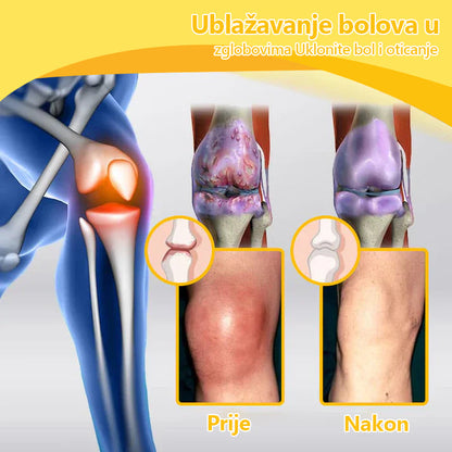 🔥🔥ArthroFree™ Krema za zacjeljivanje kostiju protiv bolova s pčelinjim otrovom🐝(Posebno za starije osobe & AAOS preporučuje)