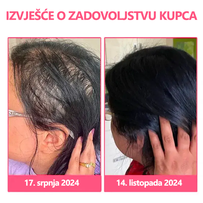 𝙇𝙀𝙁𝙐𝙉™🐝 Luxe Bee venom Scalp Treatment HairGrᴏᴡth sprej za kosu (Požurite, 80% POPUSTA - Još samo 30 minuta 🫧)