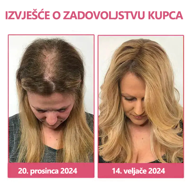 𝙇𝙀𝙁𝙐𝙉™🐝 Luxe Bee venom Scalp Treatment HairGrᴏᴡth sprej za kosu (Požurite, 80% POPUSTA - Još samo 30 minuta 🫧)