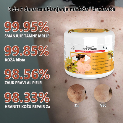 🐝🐝🍀🍀[🍀Službena Trgovina Marke🍀] 🐝🐝LENARO™ Krema za liječenje madeža od pčelinjeg otrova(👨‍⚕AAD PREPORUČUJE)1