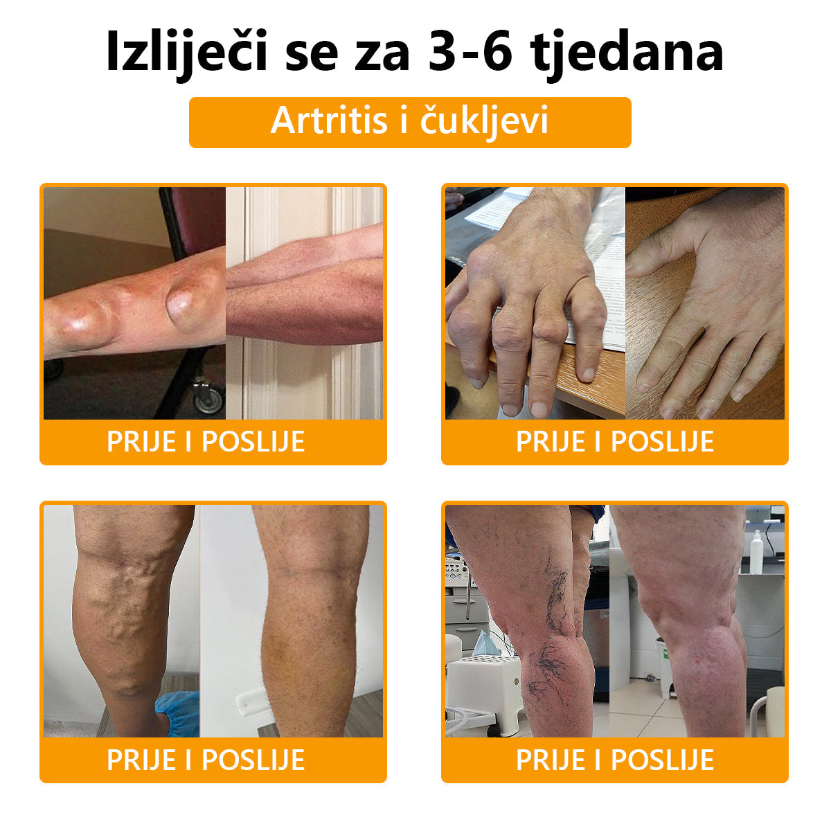 🔥🔥ArthroFree™ Krema za zacjeljivanje kostiju protiv bolova s pčelinjim otrovom🐝(Posebno za starije osobe & AAOS preporučuje)