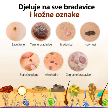 🌈🌈🧴🧴[[👑Službena Robna Marka👑] Lenaro™ Krema za Liječenje Madeža i Bradavica s Pčelinjim Otrovom (👨‍⚕EDVA PREPORUČUJE)