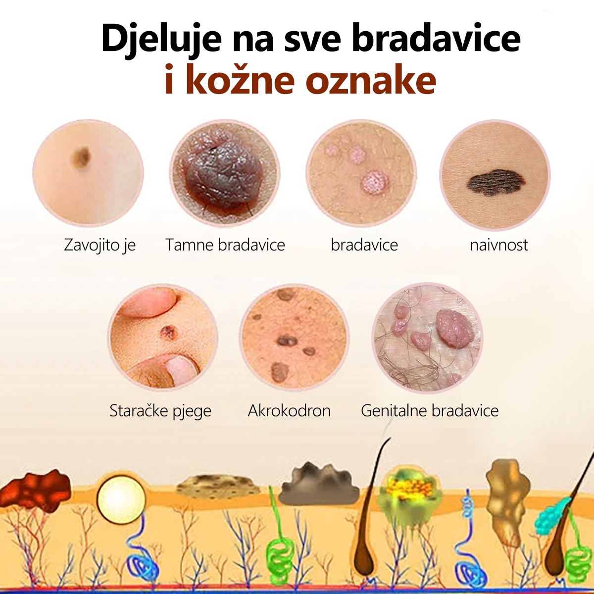 🐝🐝🍀🍀[🍀Službena Trgovina Marke🍀] 🐝🐝LENARO™ Krema za liječenje madeža od pčelinjeg otrova(👨‍⚕AAD PREPORUČUJE)1