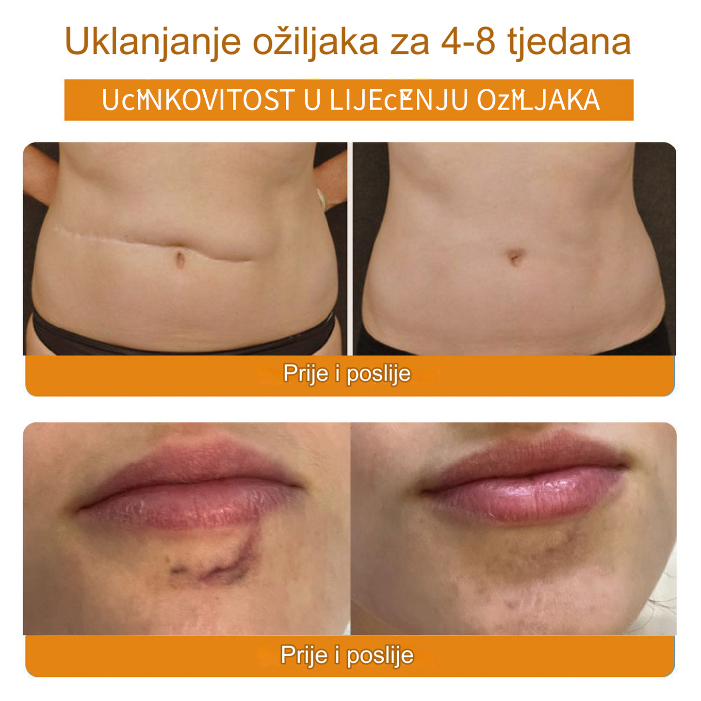 𝙇𝙀𝙁𝙐𝙉™ Krema za uklanjanje ožiljaka (Preporučeno od strane BAD-a) (🌸Zadnji dan promocije 80% popusta🌸)