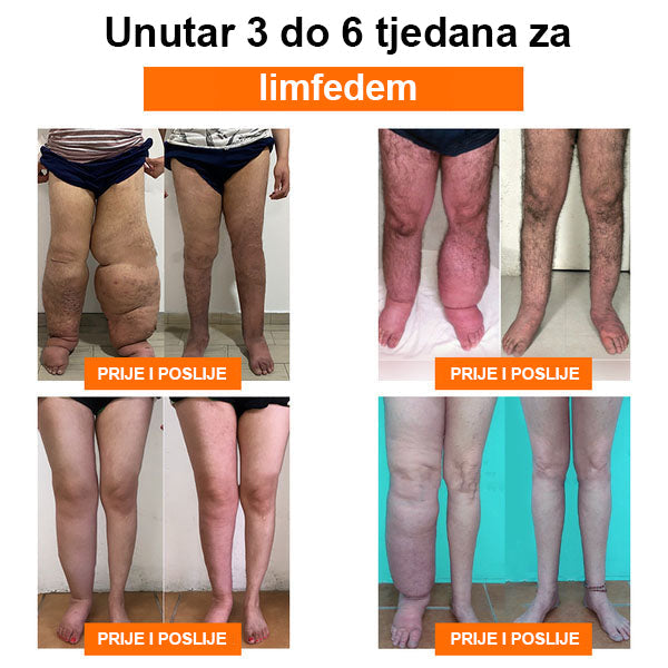 Eiceh® Radiofrekvencijska biljna toplinska podrška za koljena (Preporuke stručnjaka AAOS - za sva stanja povezana s nogama) x💖💖