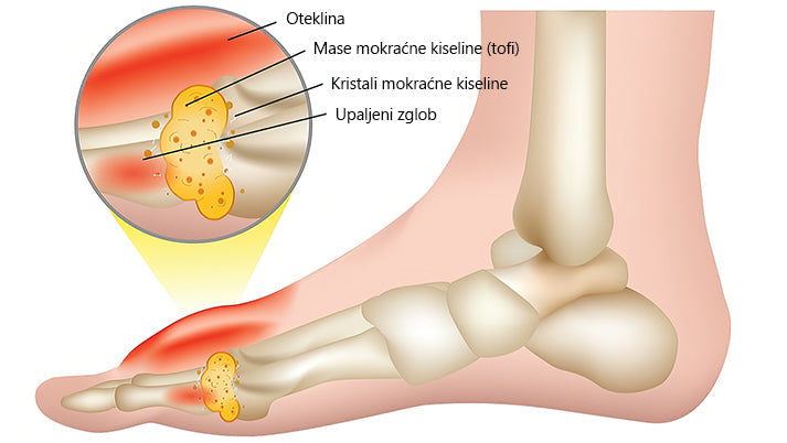 🔥🔥ArthroFree™ Krema za zacjeljivanje kostiju protiv bolova s pčelinjim otrovom🐝(Posebno za starije osobe & AAOS preporučuje)