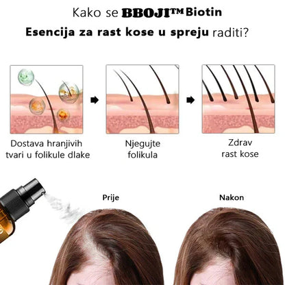 （🔥PRODAJA ZADNJEG DANA -80% POPUST) BBOJI™ Biotin Premium serum za rast kose