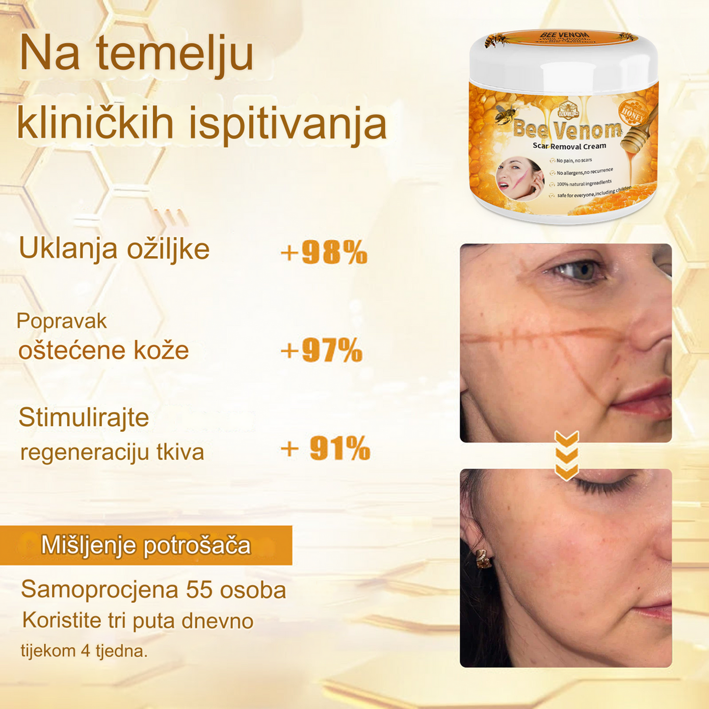 𝙇𝙀𝙁𝙐𝙉™ Krema za uklanjanje ožiljaka (Preporučeno od strane BAD-a) (🌸Zadnji dan promocije 80% popusta🌸)