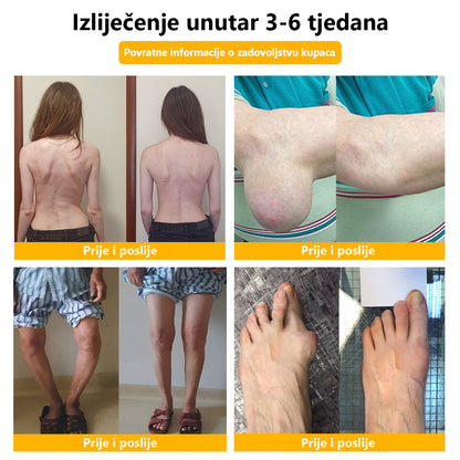 🔥🔥ArthroFree™ Krema za zacjeljivanje kostiju protiv bolova s pčelinjim otrovom🐝(Posebno za starije osobe & AAOS preporučuje)