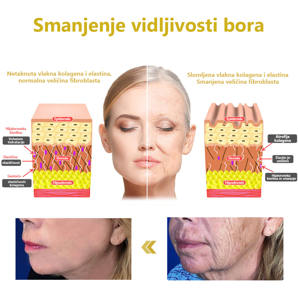 ✨✨Zadnji dan popusta: 87% POPUSTA✨ Fubsta®✨napredna krema za učvršćivanje i smanjenje bora: vratite koži elastičnost