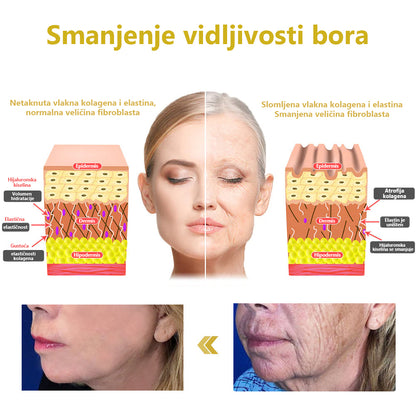 ✨✨Zadnji dan popusta: 87% POPUSTA✨ Fubsta®✨napredna krema za učvršćivanje i smanjenje bora: vratite koži elastičnost