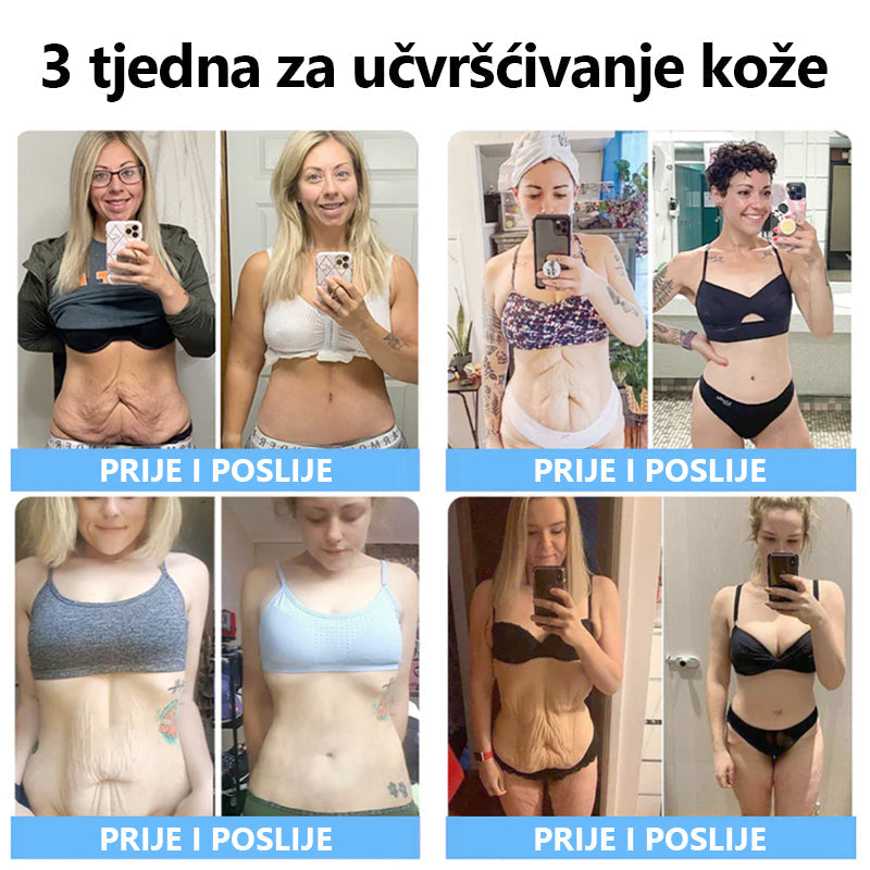 💖💖Flysmus™ Krema za uklanjanje bora adresa crepe & sagging(🔥75% popusta na ograničeno vrijeme!) x