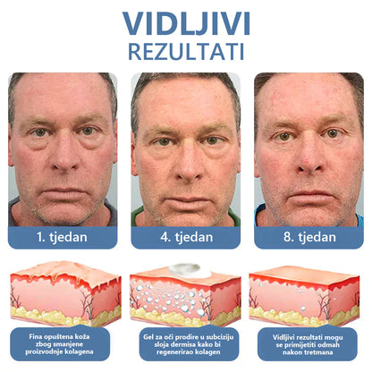 LOVILDS™ 💖 Dr. Gerald Jarl - Preporučeni proizvodi Hrvatskog očnog centra: Awaken peptidni lifting gel za oči x