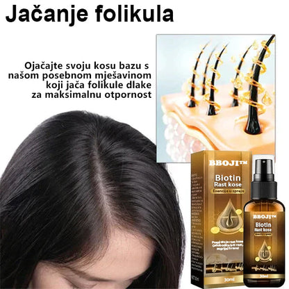 （🔥PRODAJA ZADNJEG DANA -80% POPUST) BBOJI™ Biotin Premium serum za rast kose