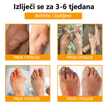 🔥🔥ArthroFree™ Krema za zacjeljivanje kostiju protiv bolova s pčelinjim otrovom🐝(Posebno za starije osobe & AAOS preporučuje)