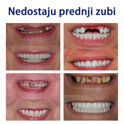 Bikenda™ Silikonski Set Za Mjerenje Proteza 🧨🧨 (👩‍🔬 CED sukladan, odobren od strane profesionalnih stomatologa)