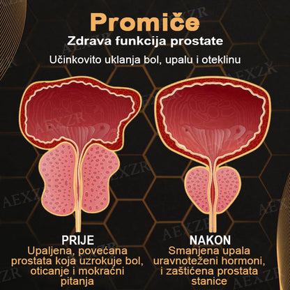 Cvreoz™ Flaster za detoksikaciju prostate s pčelinjim otrovom💪