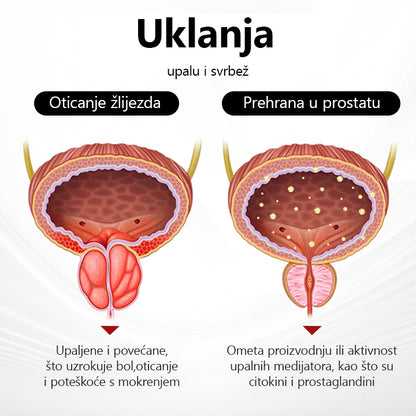 Probudite skrivenu snagu unutar svog tijela🔥Biancat™ ProstaAir Dvostruko Funkcionalni Nosni Inhalator(⏰Do 80% popusta, odbrojavanje 30 minuta⏰)