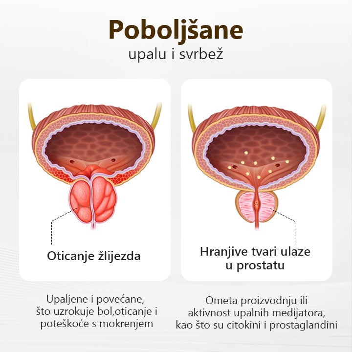 Oslobodite mušku snagu🚀🚀 Inhalator Biancat™ ProstaVibe Pčelinje Dobrobit(🔥Ograničena ponuda80%  samo danas🔥)