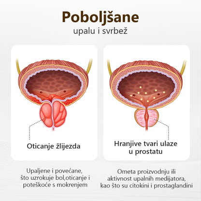 Oslobodite mušku snagu🚀🚀 Inhalator Biancat™ ProstaVibe Pčelinje Dobrobit(🔥Ograničena ponuda80%  samo danas🔥)