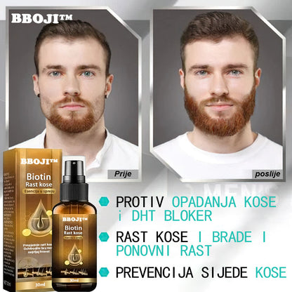 （🔥PRODAJA ZADNJEG DANA -80% POPUST) BBOJI™ Biotin Premium serum za rast kose