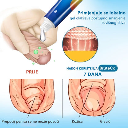 BruteCo™ gel za korekciju neželjene kožice(🔥 Zadnji dan akcije, 80% popusta🔥)