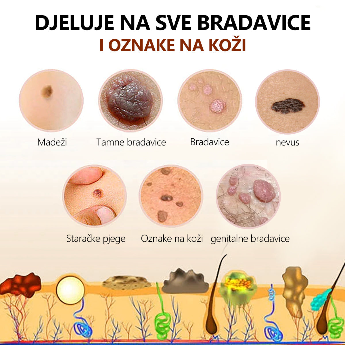 [🍀Službena Trgovina Marke🍀] 🐝🐝LEFUN™ Krema za liječenje madeža i bradavica s pčelinjim otrovom(👨‍⚕AAD PREPORUČUJE)2