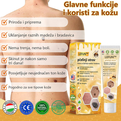 [🍀Službena Trgovina Marke🍀] 🐝🐝LEFUN™ Krema za liječenje madeža i bradavica s pčelinjim otrovom(👨‍⚕AAD PREPORUČUJE)2