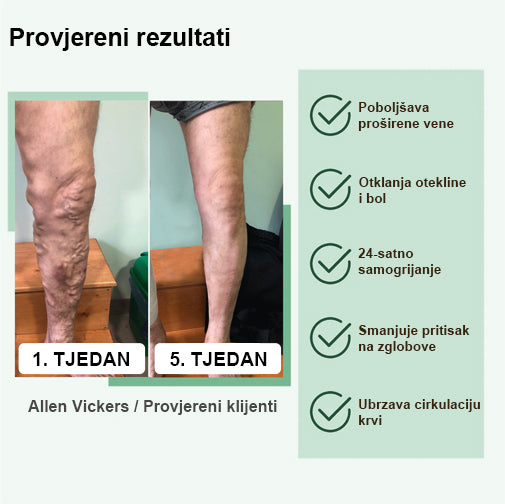 Eiceh® Radiofrekvencijska biljna toplinska podrška za koljena (Preporuke stručnjaka AAOS - za sva stanja povezana s nogama) x💖💖