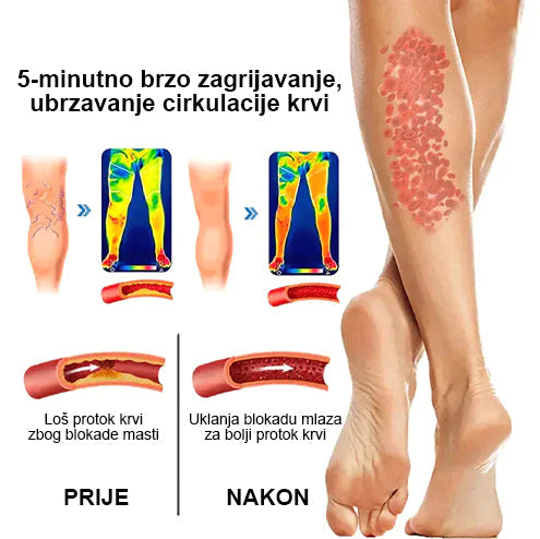 Eiceh® Radiofrekvencijska biljna toplinska podrška za koljena (Preporuke stručnjaka AAOS - za sva stanja povezana s nogama) x💖💖