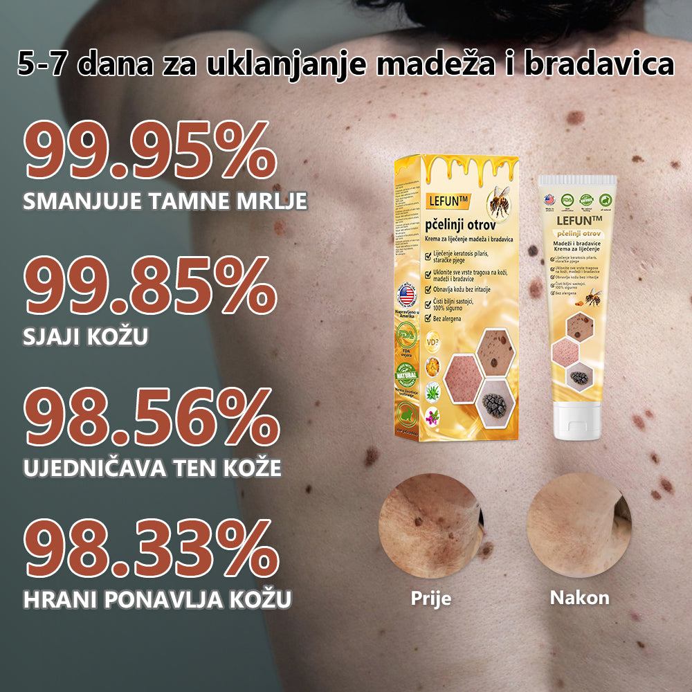 [🍀Službena Trgovina Marke🍀] 🐝🐝LEFUN™ Krema za liječenje madeža i bradavica s pčelinjim otrovom(👨‍⚕AAD PREPORUČUJE)2