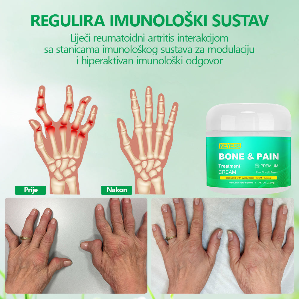 🎁🎁KEYESS® Organic Boswellia krema za liječenje kostiju i bolova 💧 Specijalizirana za ortopedska stanja i bolove