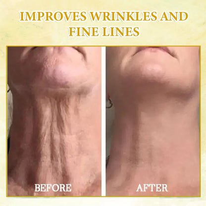 🎶🎶𝐋𝐚𝐬𝐭 𝐃𝐚𝐲 𝐃𝐢𝐬𝐜𝐨𝐮𝐧𝐭: 𝟕𝟎% 𝐎𝐅𝐅 LEFUN® SkinFirming Rejuvenating Oil