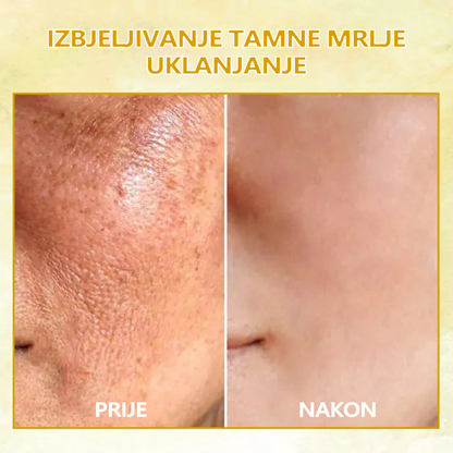 🔥🔥🔥🔥Sleva na poslední den: 70% sleva na Fubsta® SkinFirming Rejuvenating Oil