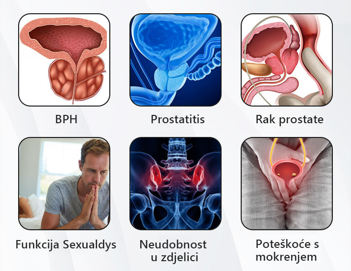 🚀💪CZTICLE™ Bakreni puls magnetska narukvica za zdravlje prostate x