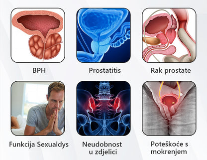 🚀💪CZTICLE™ Bakreni puls magnetska narukvica za zdravlje prostate x