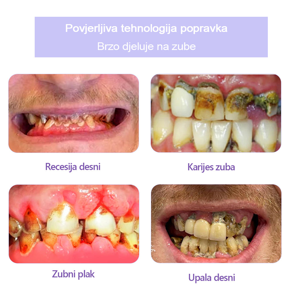 GarageLine™ (preporučeno od strane ADA) Mineralni prah za obnovu zubi (⏰Ograničena vremenska ponuda, posljednjih 30 minuta⏰) 🪥🦷