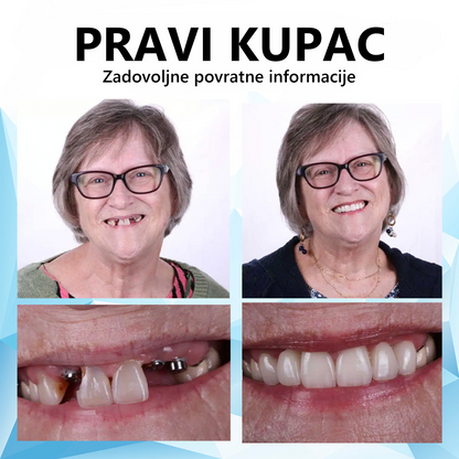 💎🦷𝐁𝐢𝐤𝐞𝐧𝐝𝐚™ Silikonski set za učvršćivanje proteza (⏰Ograničeno vrijeme popusta! Preostalo 30 minuta⏰)