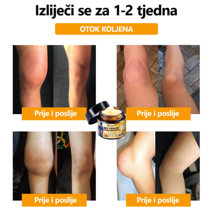 Za pomlađivanje kostura!🎁🎁Aetheris™ krema za liječenje artritisa s pčelinjim otrovom i kurkumom—🔥specijalizirana za ortopedska stanja i bolove u zglobovima