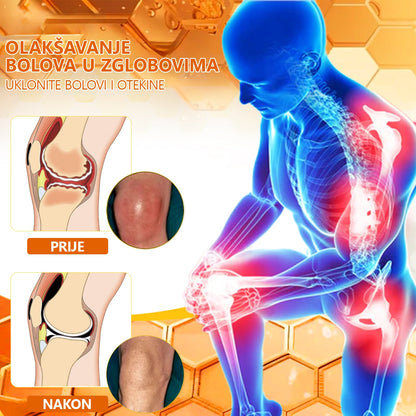 Za pomlađivanje kostura!🎁🎁Aetheris™ krema za liječenje artritisa s pčelinjim otrovom i kurkumom—🔥specijalizirana za ortopedska stanja i bolove u zglobovima